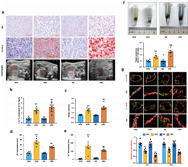 NAFLD小鼠冠狀動(dòng)脈微血管內皮通透性增強