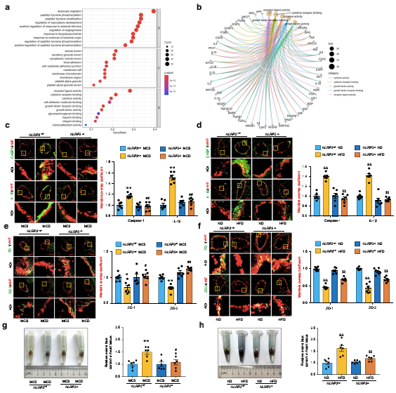 NLRP3炎癥小體介導NAFLD小鼠冠狀動(dòng)脈微血管內皮高通透性