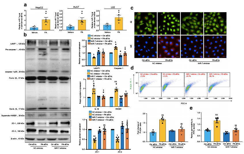 novel-miR-7的基因抑制可改善NAFLD肝源性外泌體誘導的微血管內皮高通透性